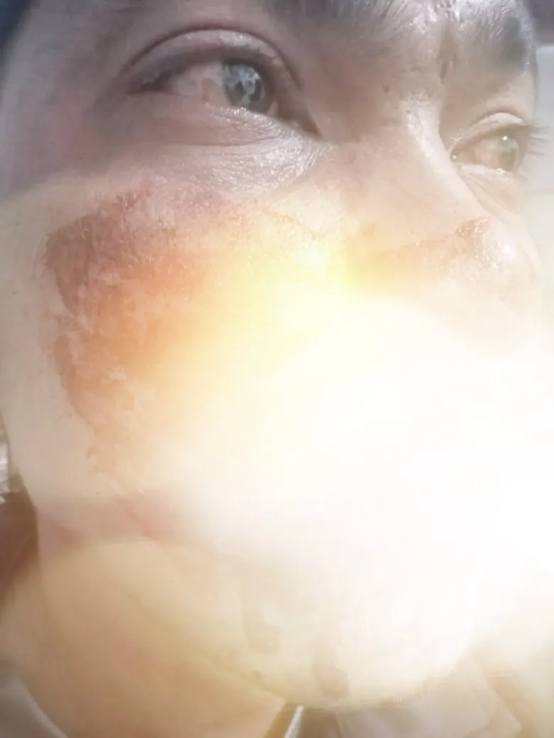 Miris, Petrus Tumanan Dibacok di Pesta Pernikahan